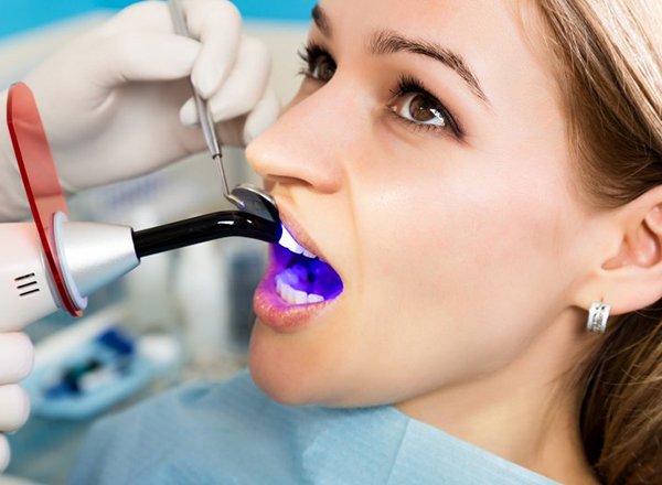 woman getting dental bonding 