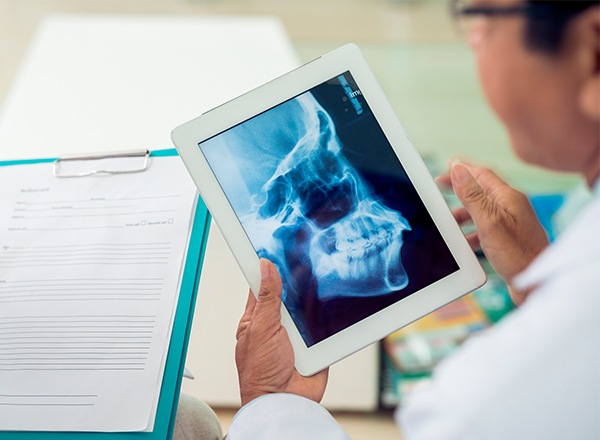 Digital jaw and skullbone x-rays