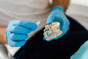 dentist showing a model of dental implants at a consultation